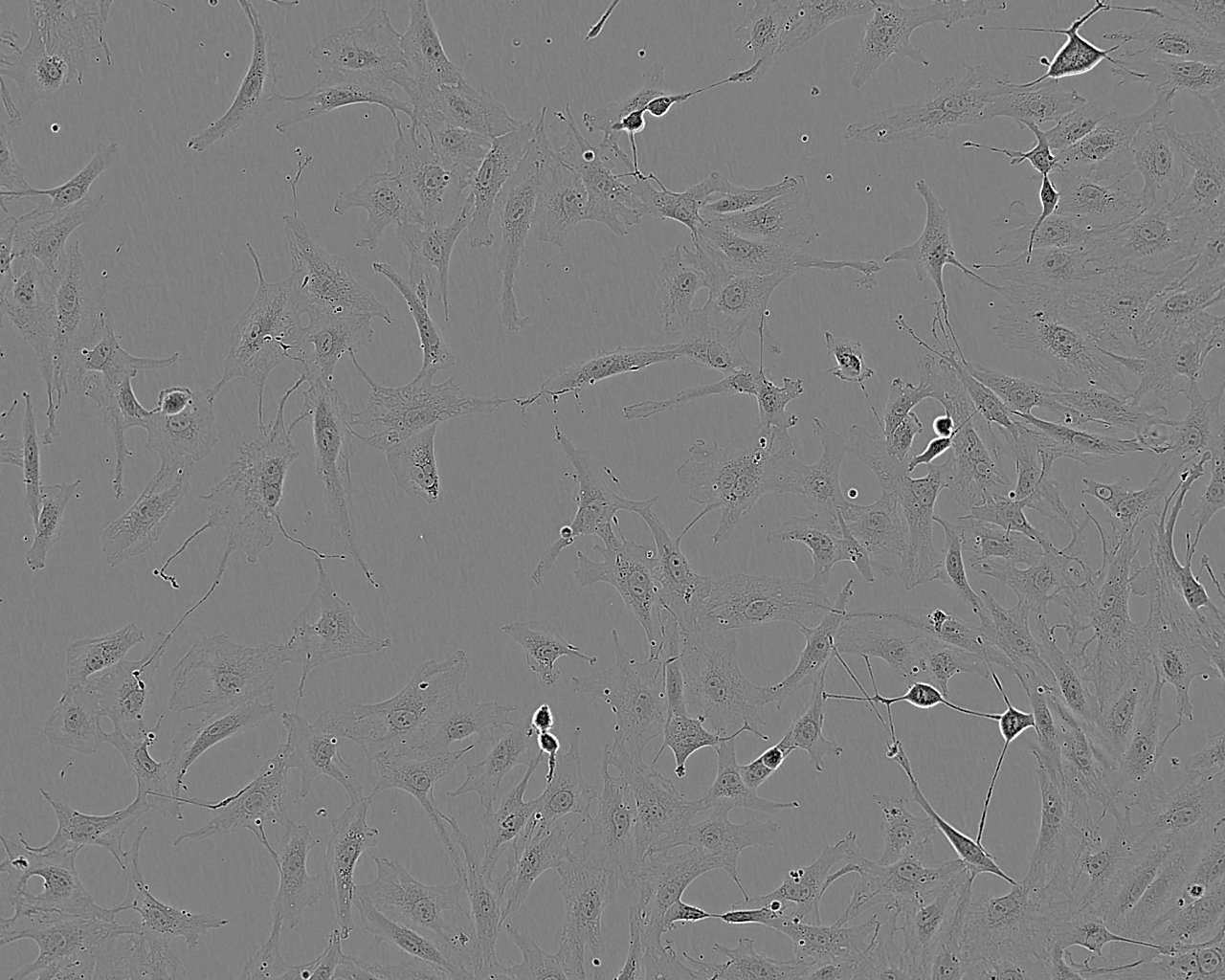 PT-K75 Cell:猪鼻甲黏膜成纤维细胞系