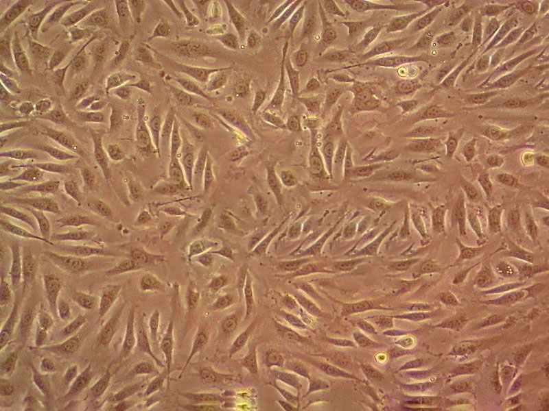 SK-LMS-1 Cell:人阴户平滑肌肉瘤细胞系