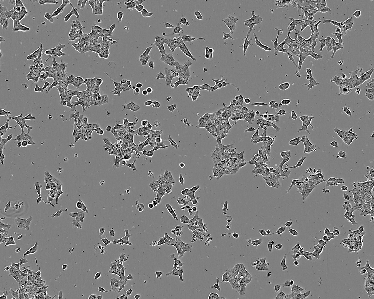 SSP-25 Cell:人肝胆管癌细胞系