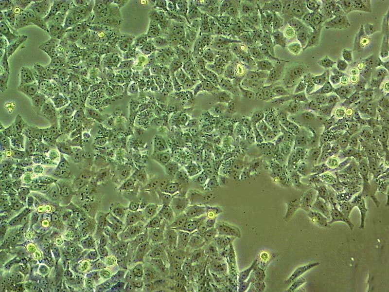 LNCaP C4-2 Cell:人前列腺癌细胞系