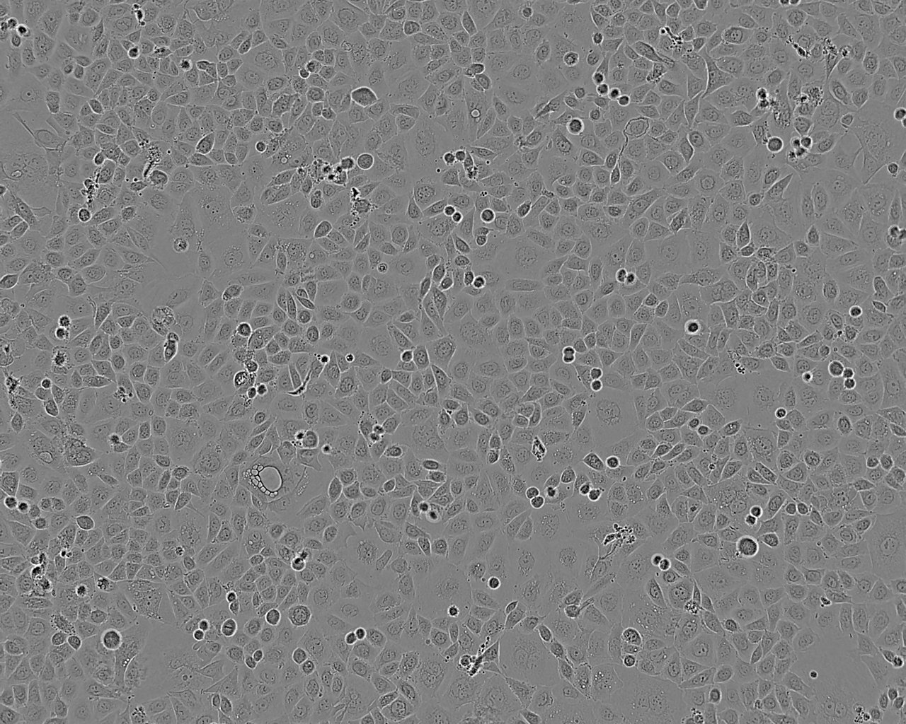 LNCaP C4-2B Cell:人前列腺癌细胞系