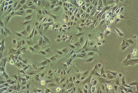 LIM1215 Cell:人结直肠癌细胞系