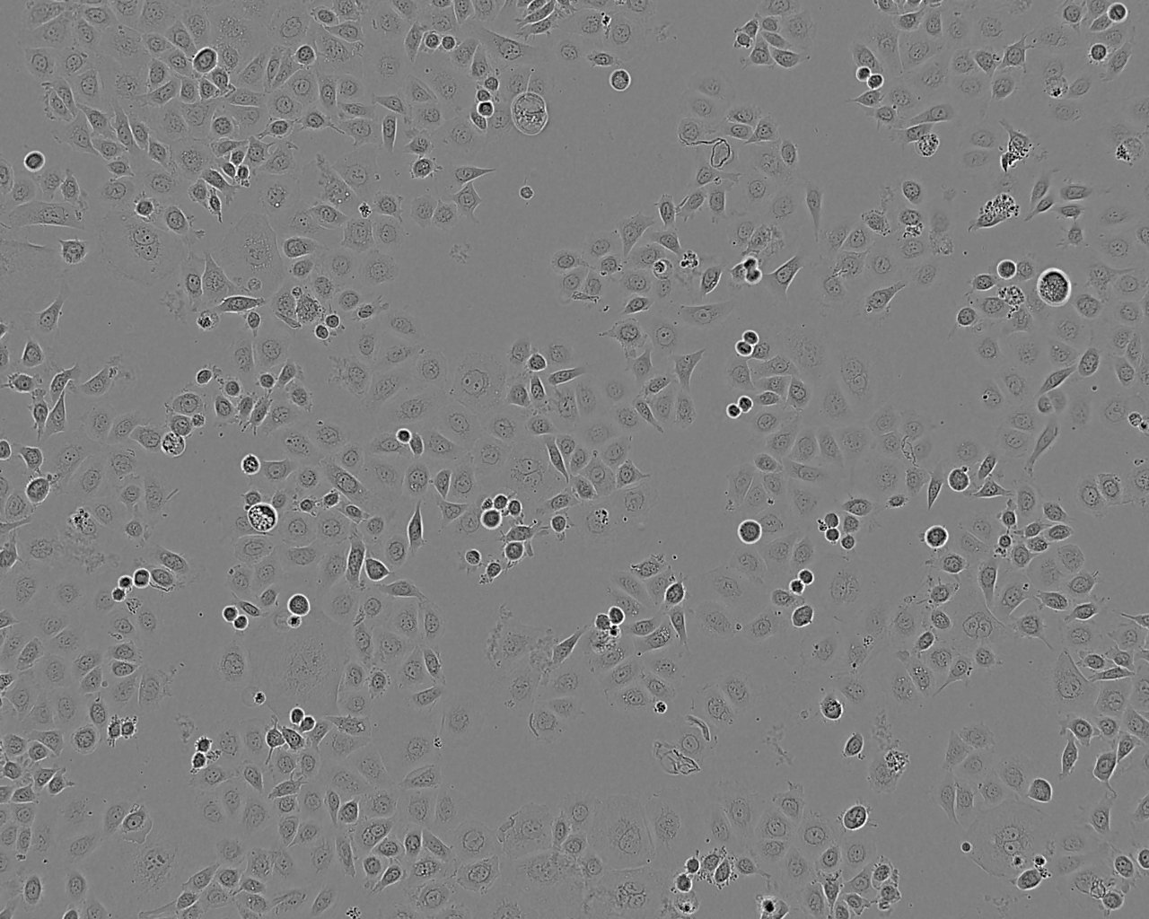 MPC-5 Cell:小鼠肾足细胞系