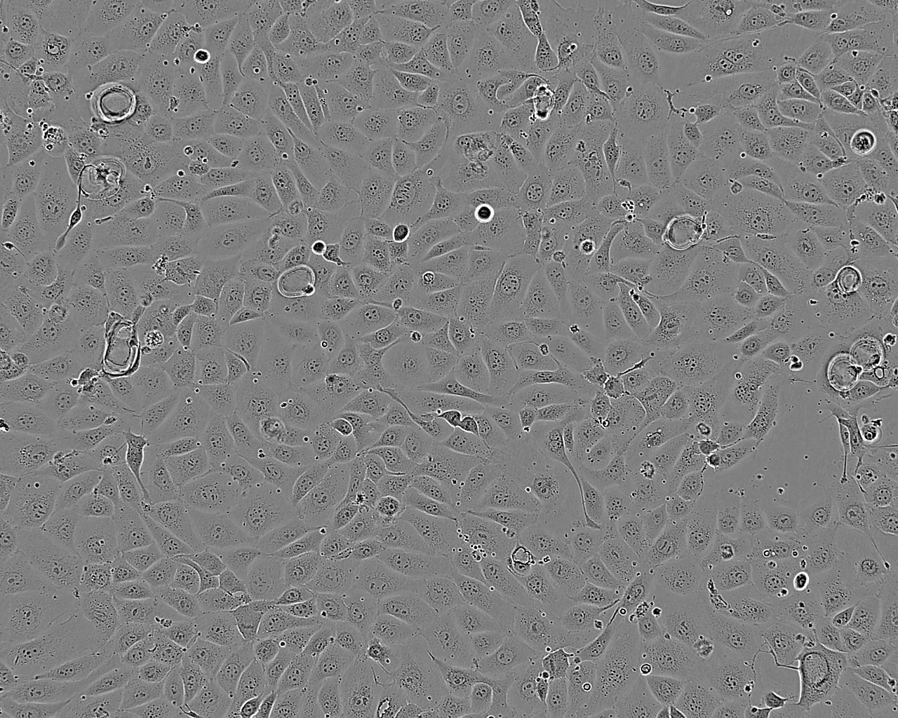 hEM15A Cell:人永生化子宫内膜异位症患者在位内膜间质细胞系