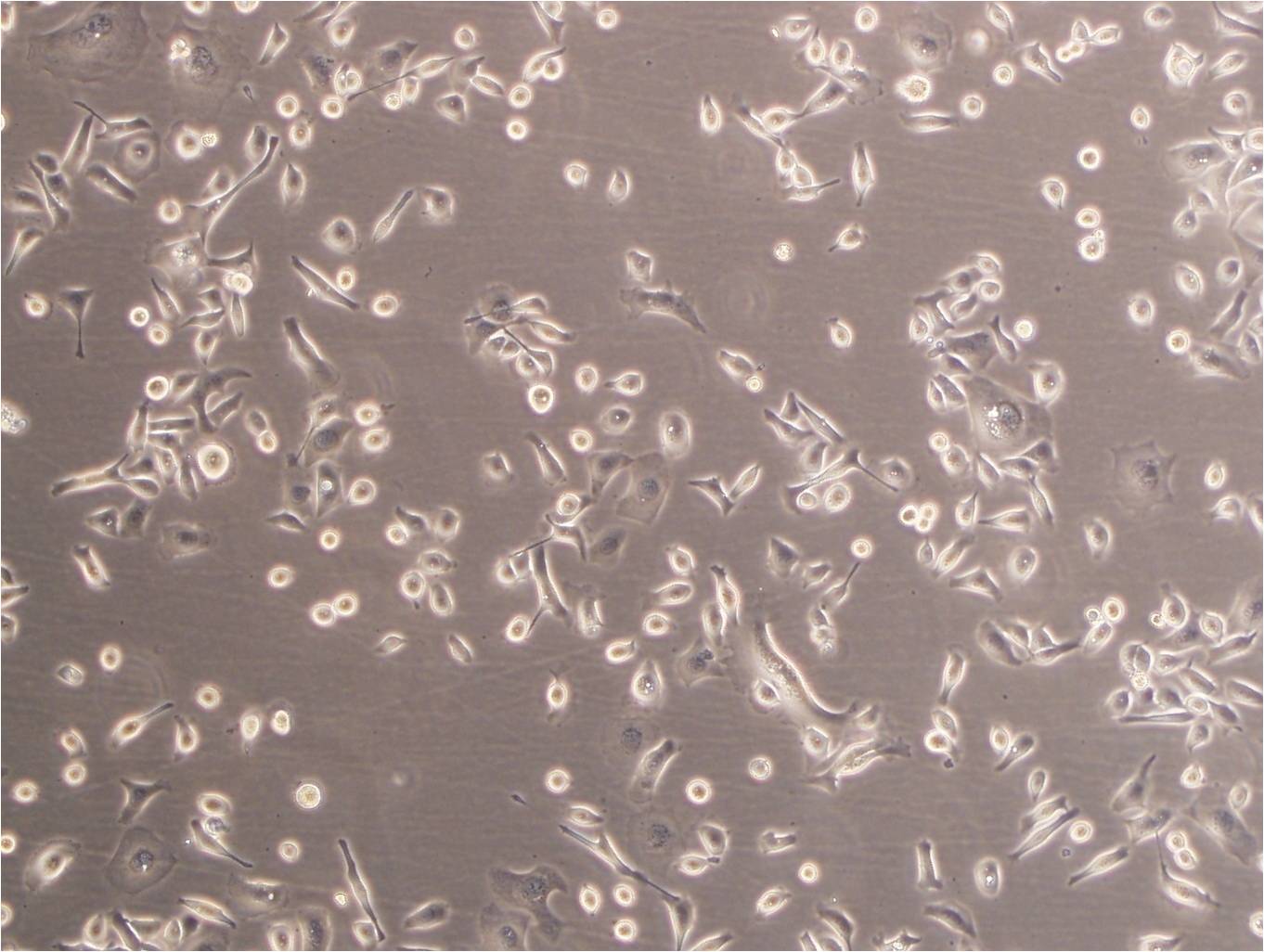 EBC-1 Cell:人肺鳞癌细胞系