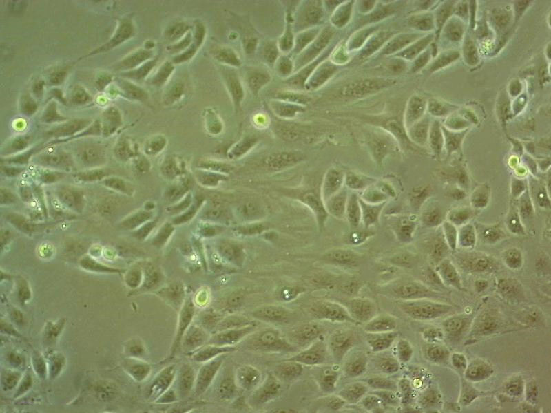 HPC-Y5 Cell:人胰腺导管癌细胞系