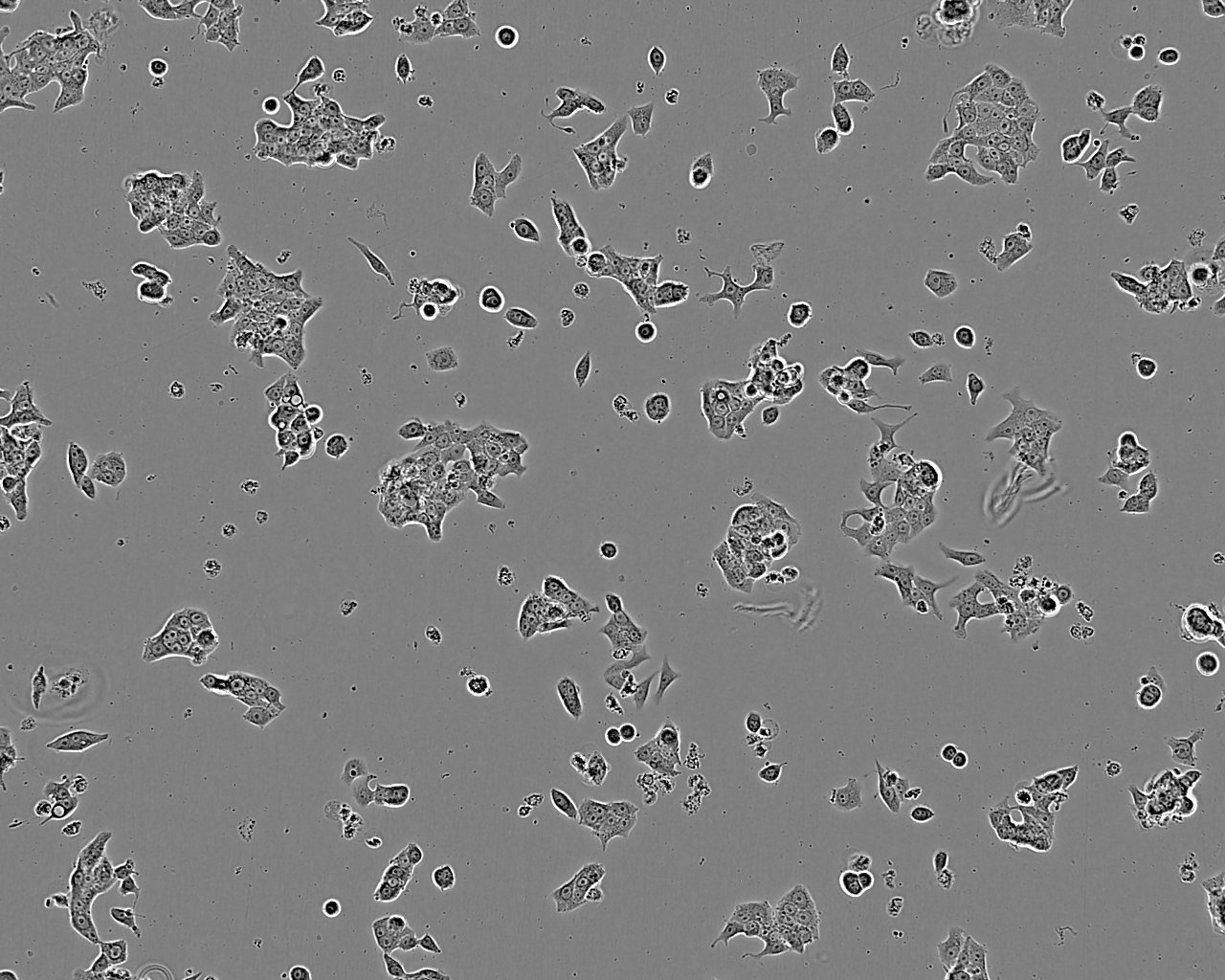 HCC1588 Cell:人肺鳞癌细胞系