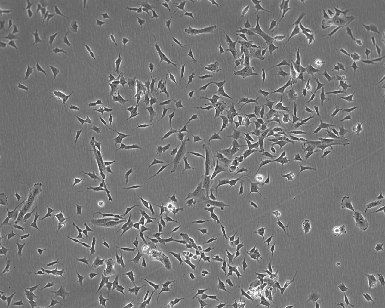 RIN-m5F Cell:大鼠胰岛β细胞瘤细胞系