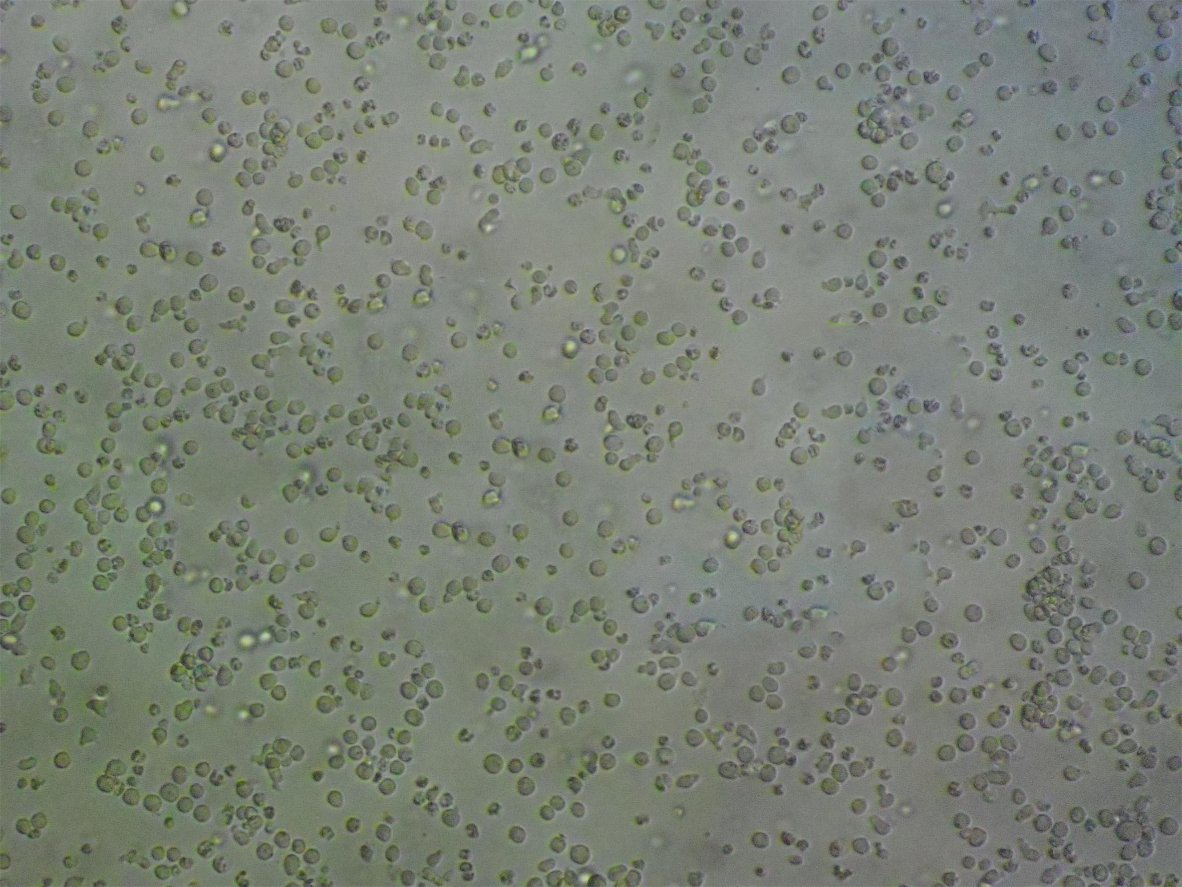 HT Cell:人混合淋巴瘤细胞系