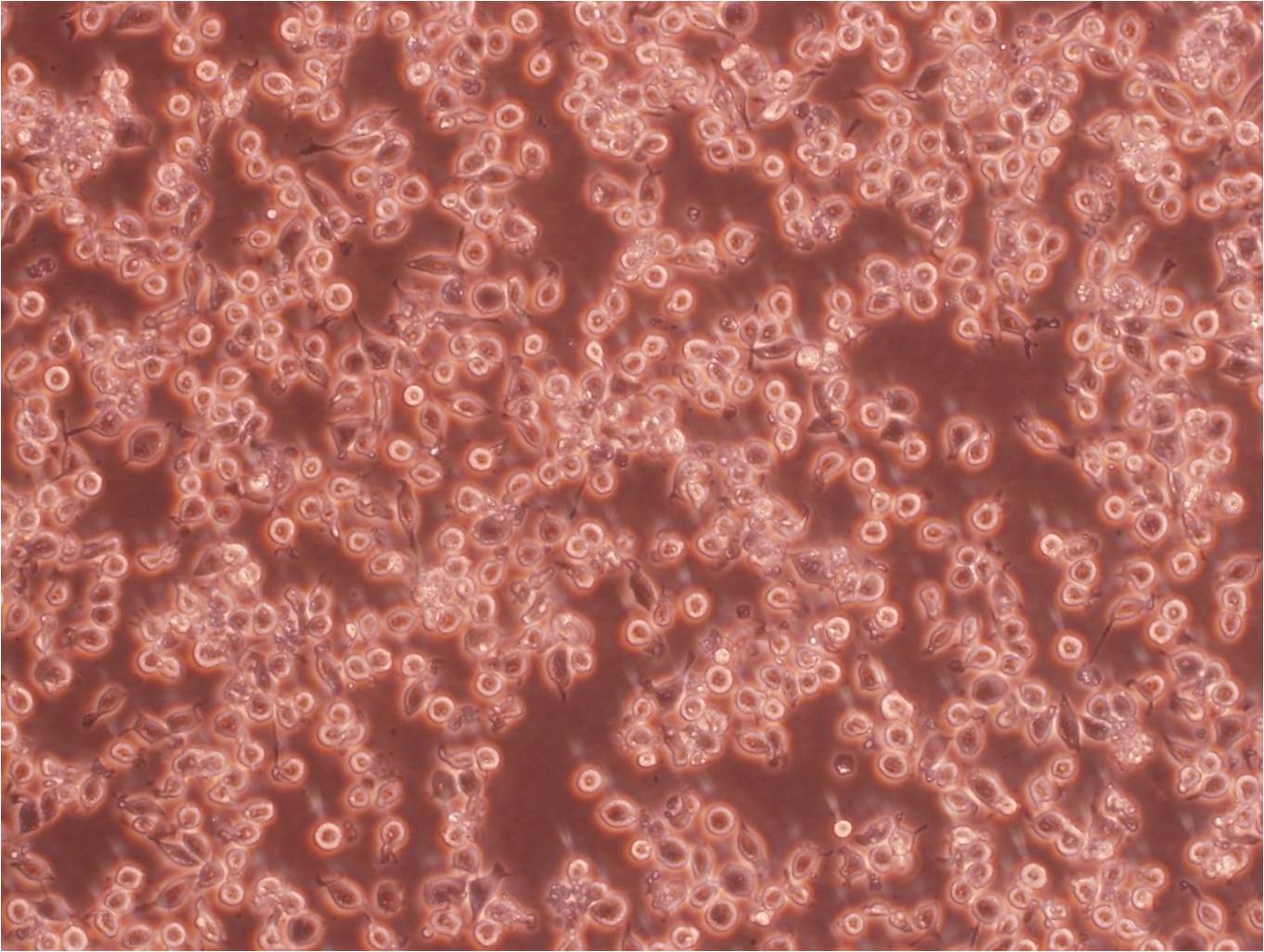 Granta-519 Cell:人类B细胞淋巴癌细胞系