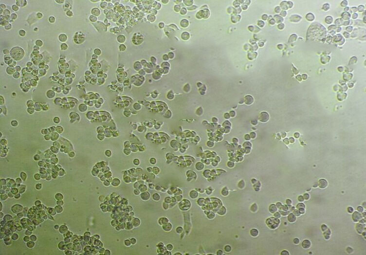 MAVER-1 Cell:人淋巴细胞瘤细胞系