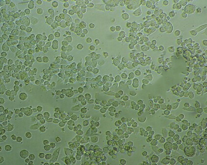 KCL-22 Cell:人慢性粒细胞白血病细胞系