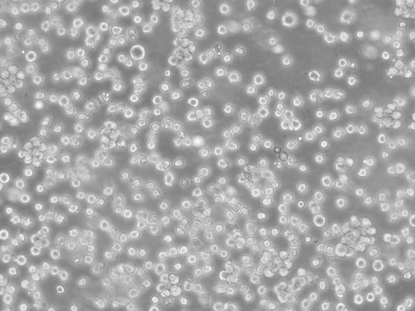 NALM-6 Cell:人急性B淋巴白血病细胞系