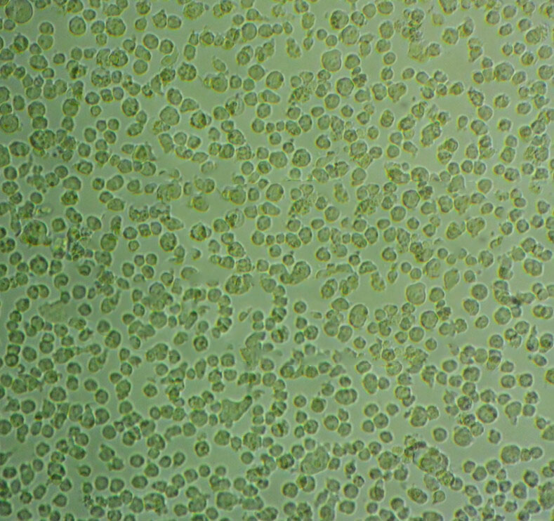 OCI-Ly18 Cell:人弥漫大B细胞淋巴瘤细胞系