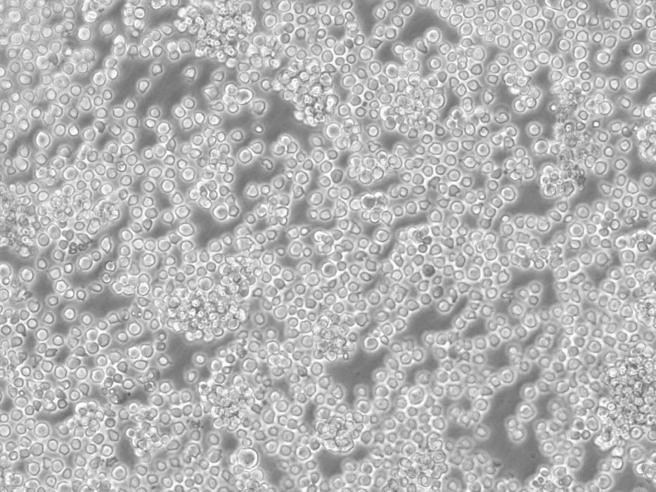 C8166 Cell:人T淋巴细胞白血病细胞系