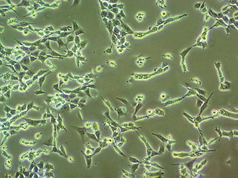 COLO 320HSR epithelioid cells人结直肠腺癌细胞系