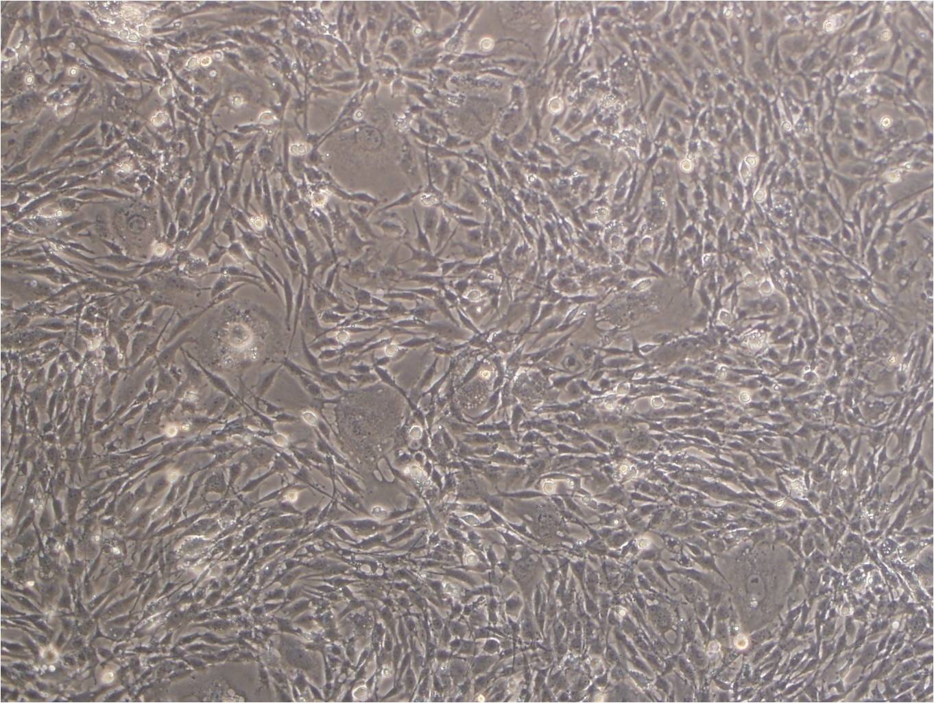 NCI-H508 epithelioid cells人结肠直肠腺癌细胞系