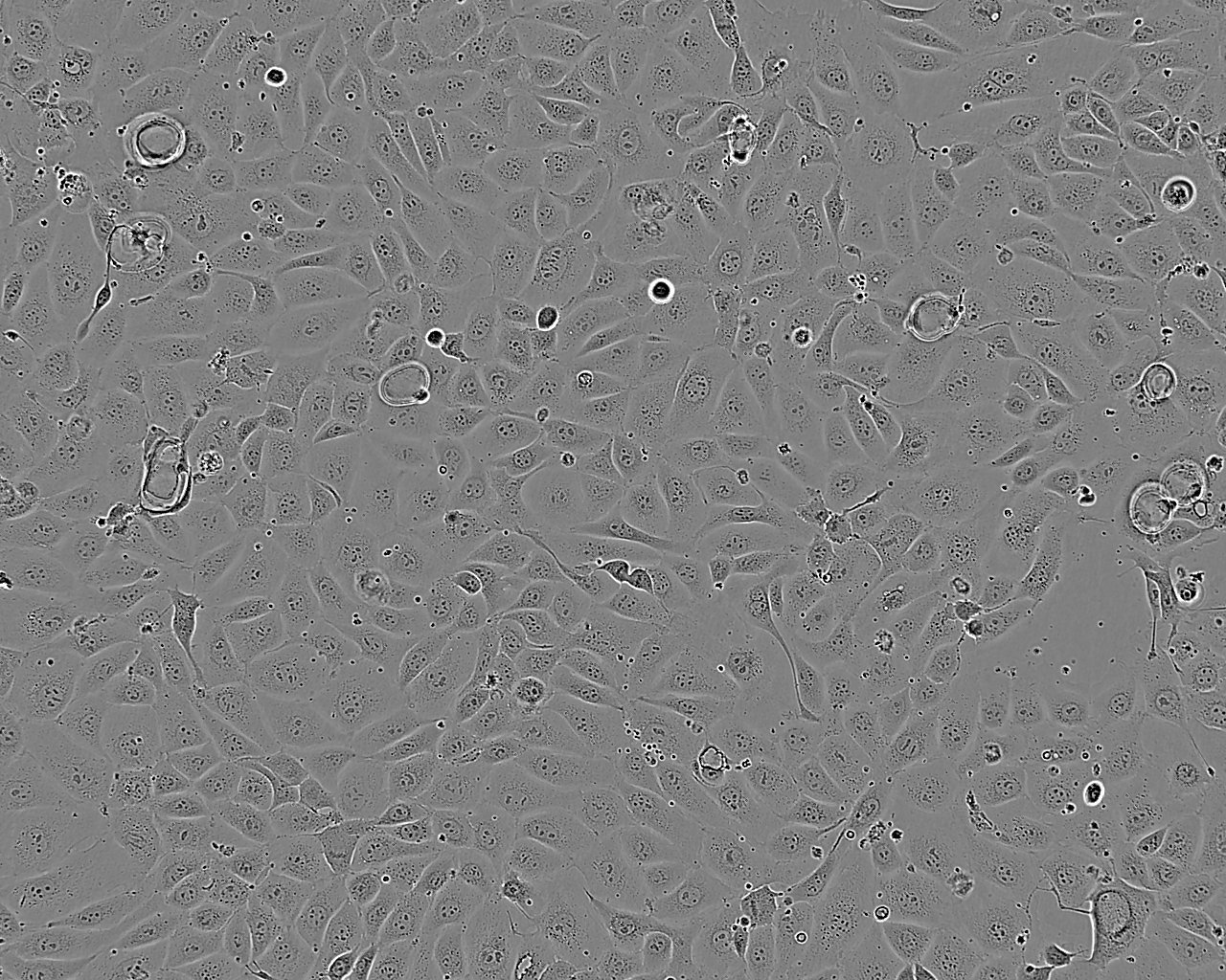 LoVo epithelioid cells人结肠癌细胞系