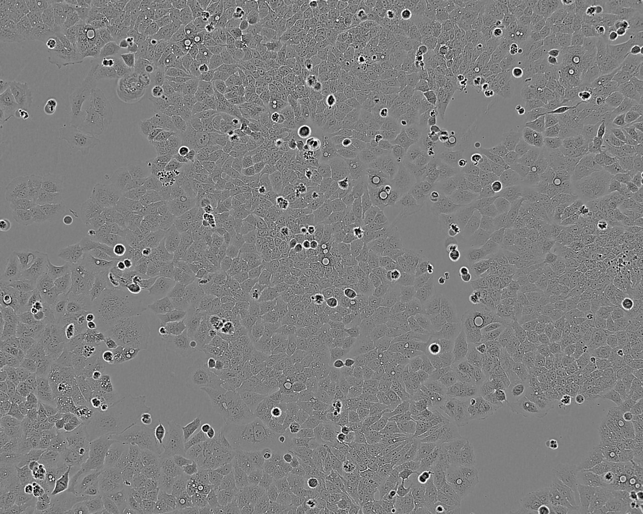 OPM-2 epithelioid cells人骨髓瘤细胞系