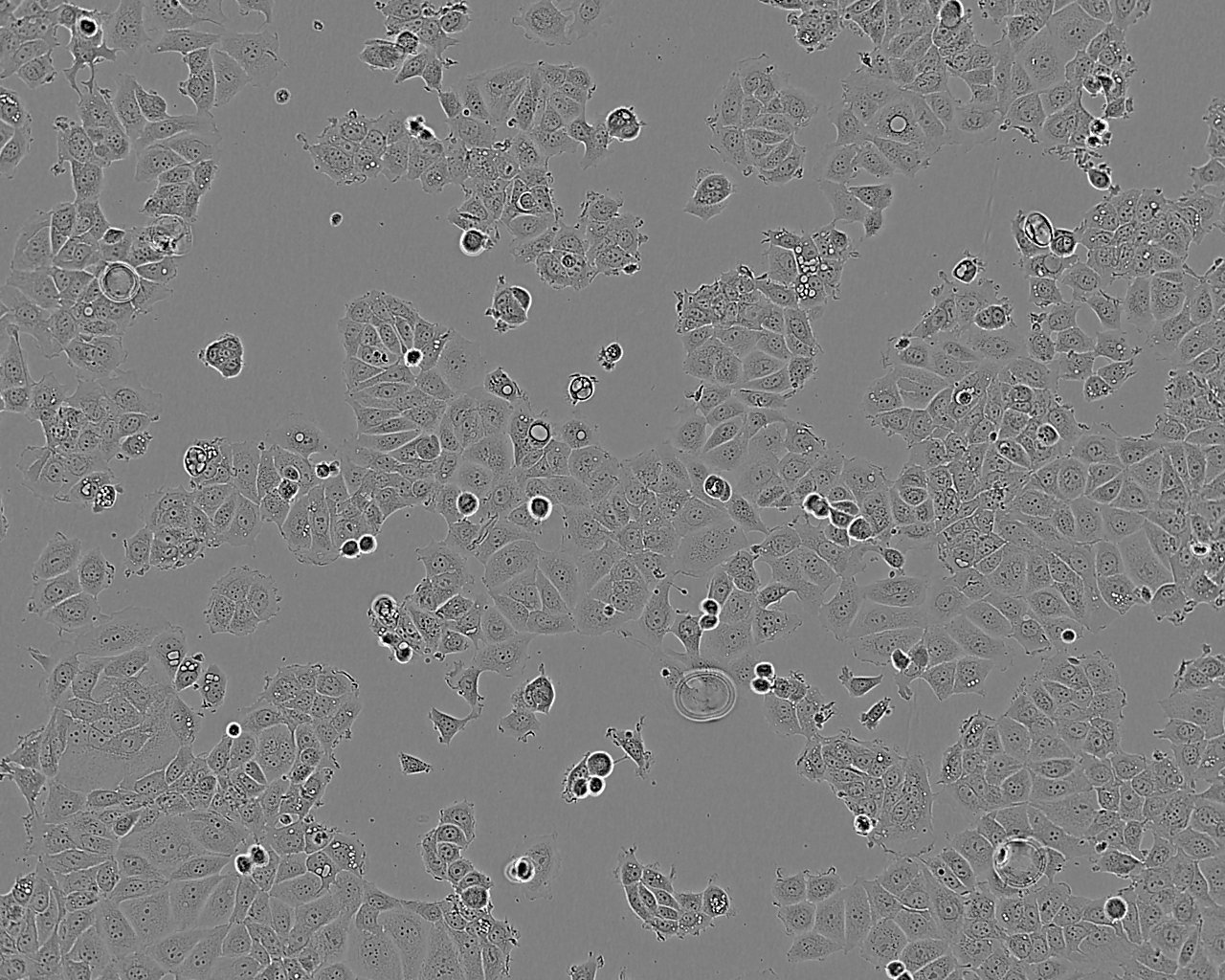 QGY-7703 epithelioid cells人肝癌细胞系