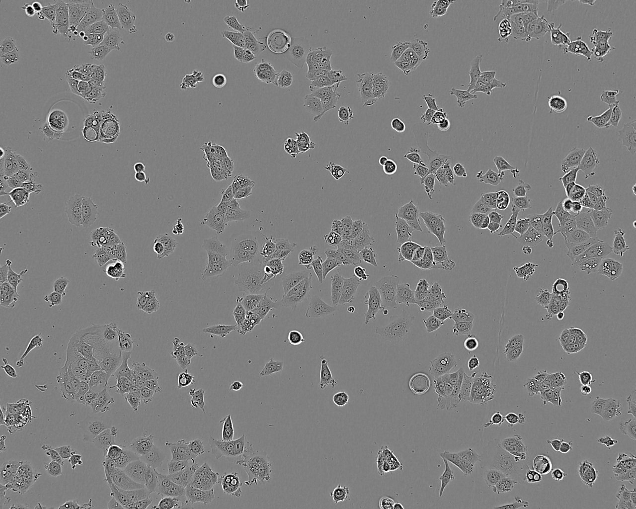 QGY-7701 epithelioid cells人肝癌细胞系