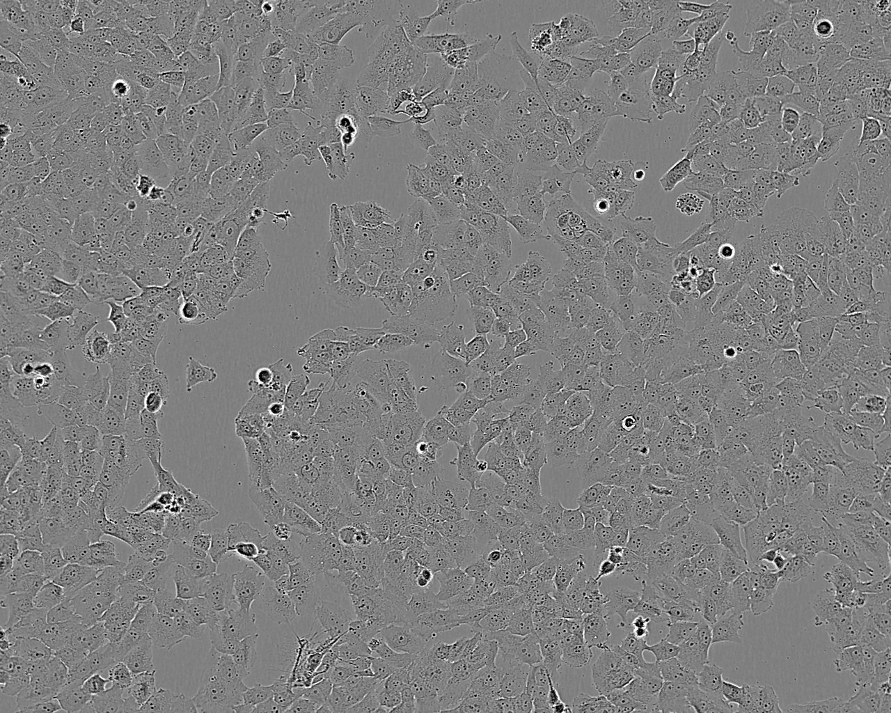 BEL-7402 epithelioid cells人肝癌细胞系