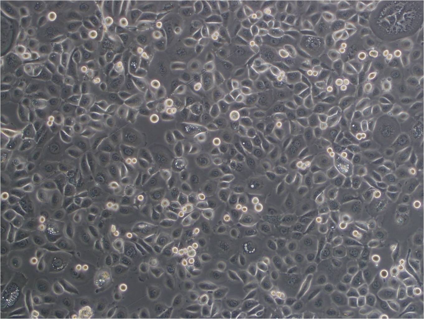 UM-UC-3 epithelioid cells人膀胱移行癌细胞系