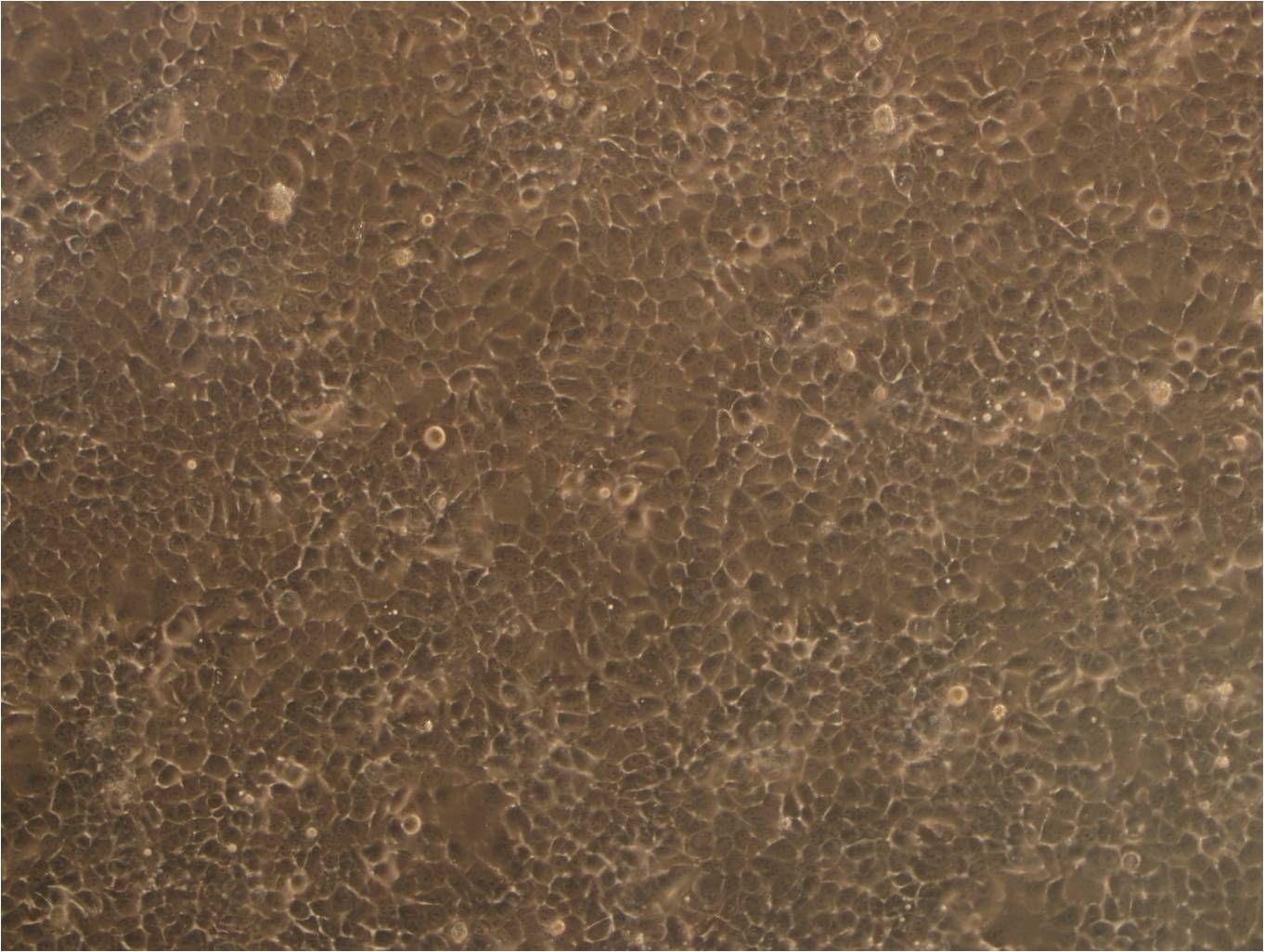 HTR-8 epithelioid cells人滋养细胞系