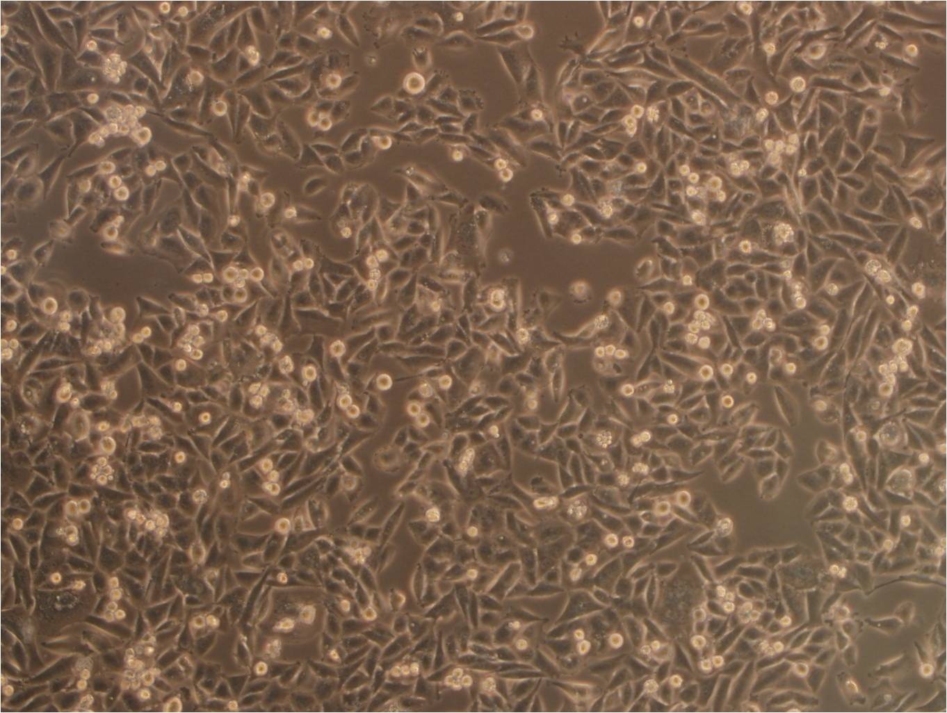 MDA-MB-231 epithelioid cells人乳腺癌细胞系