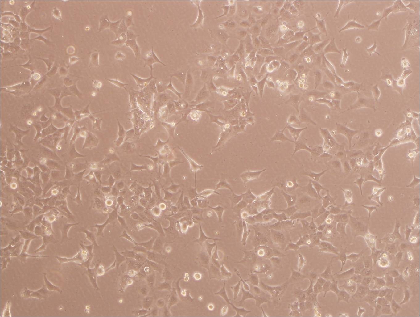 KP-N-NS epithelioid cells人肾上腺神经母细胞瘤细胞系