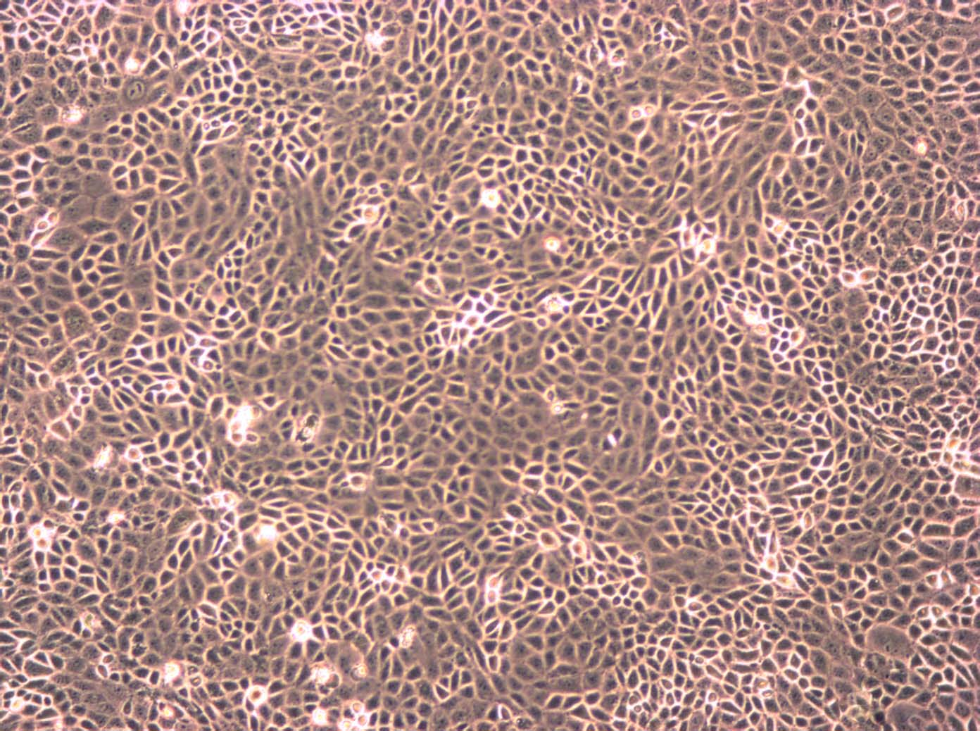 JAR epithelioid cells人胎盘绒毛癌细胞系