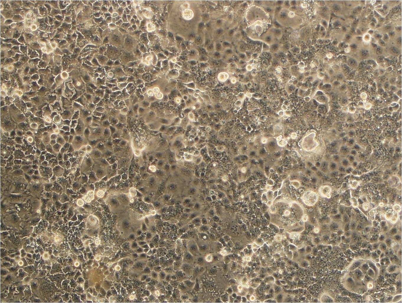 NCI-N87 epithelioid cells人胃癌细胞系