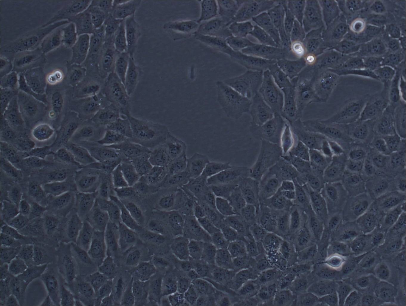 F56 [Human neoplasm] epithelioid cells人腺癌细胞系