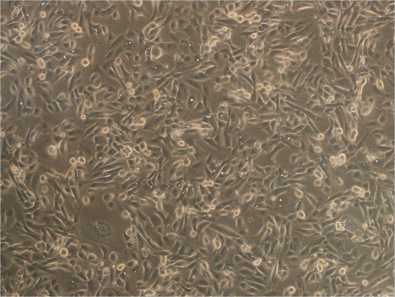 AN3-CA epithelioid cells人子宫内膜腺癌细胞系