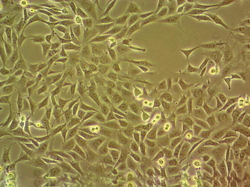 KLE epithelioid cells人子宫内膜癌细胞系