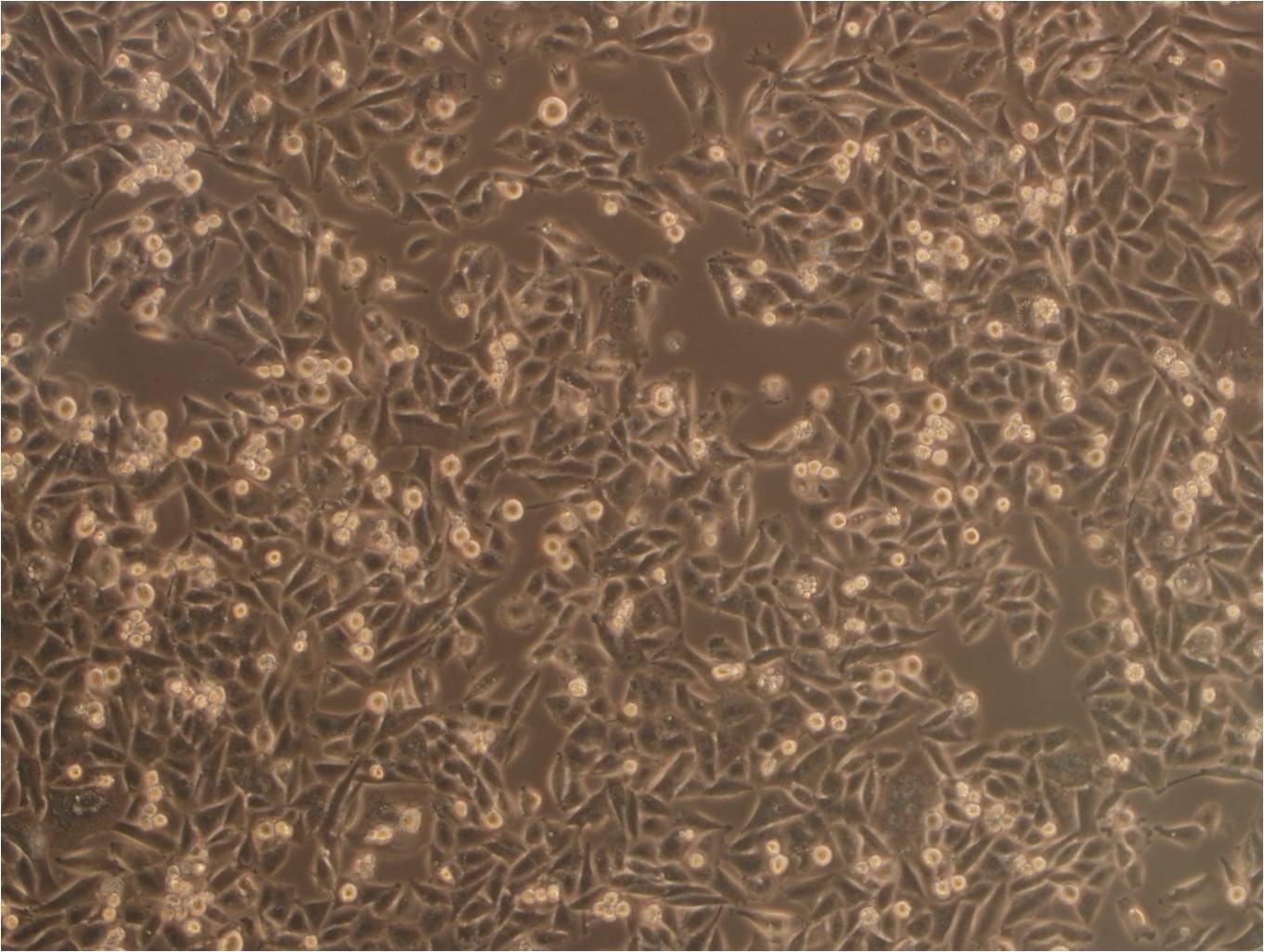 Ishikawa epithelioid cells人子宫内膜癌细胞系