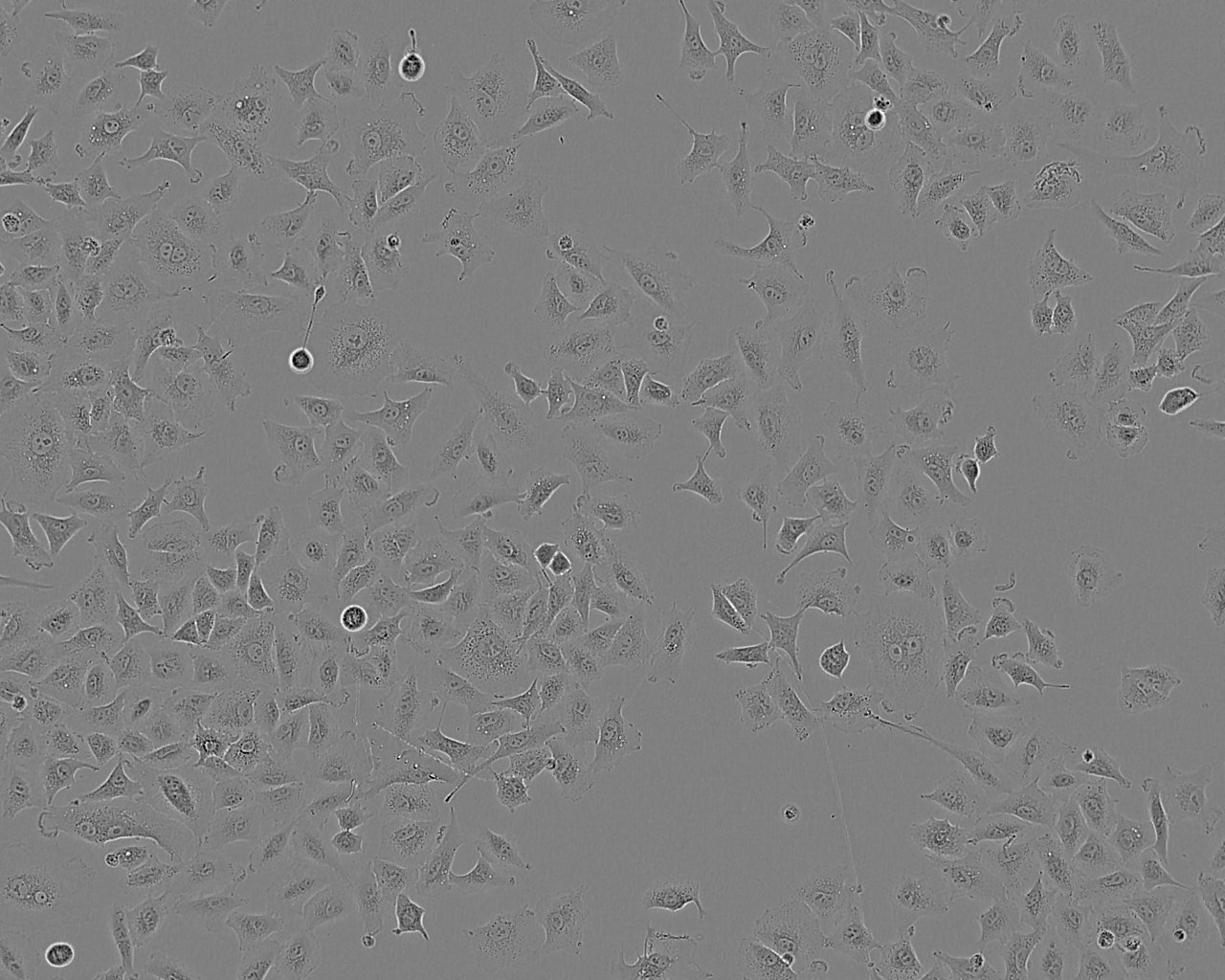 ATDC-5 epithelioid cells小鼠胚胎瘤细胞系