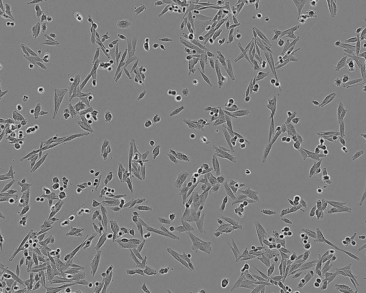 GB-1 epithelioid cells人脑胶质母细胞瘤细胞系