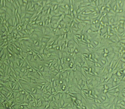 MFE-296 epithelioid cells子宫内膜癌细胞系