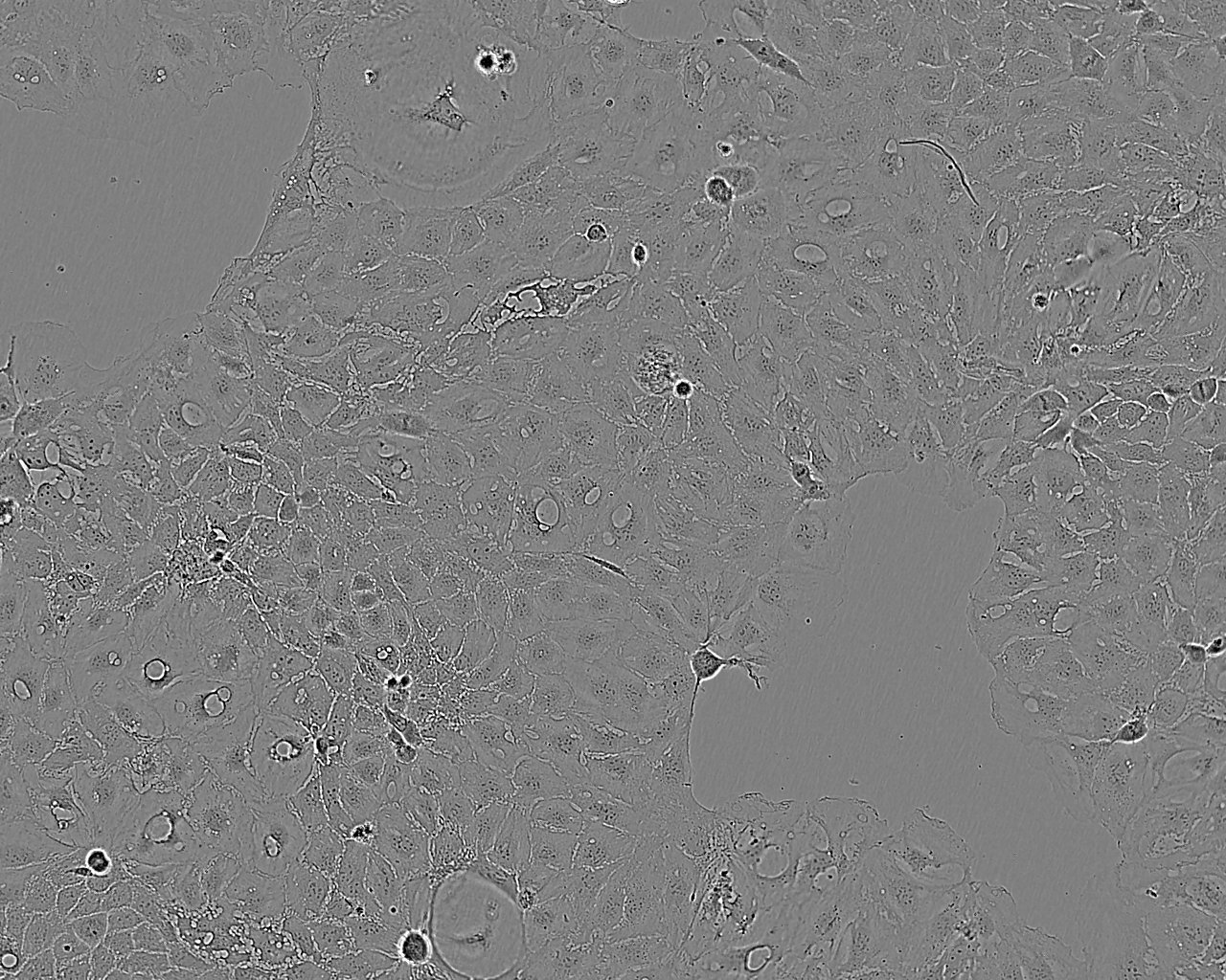 ABC-1 epithelioid cells人肺癌腺癌细胞系