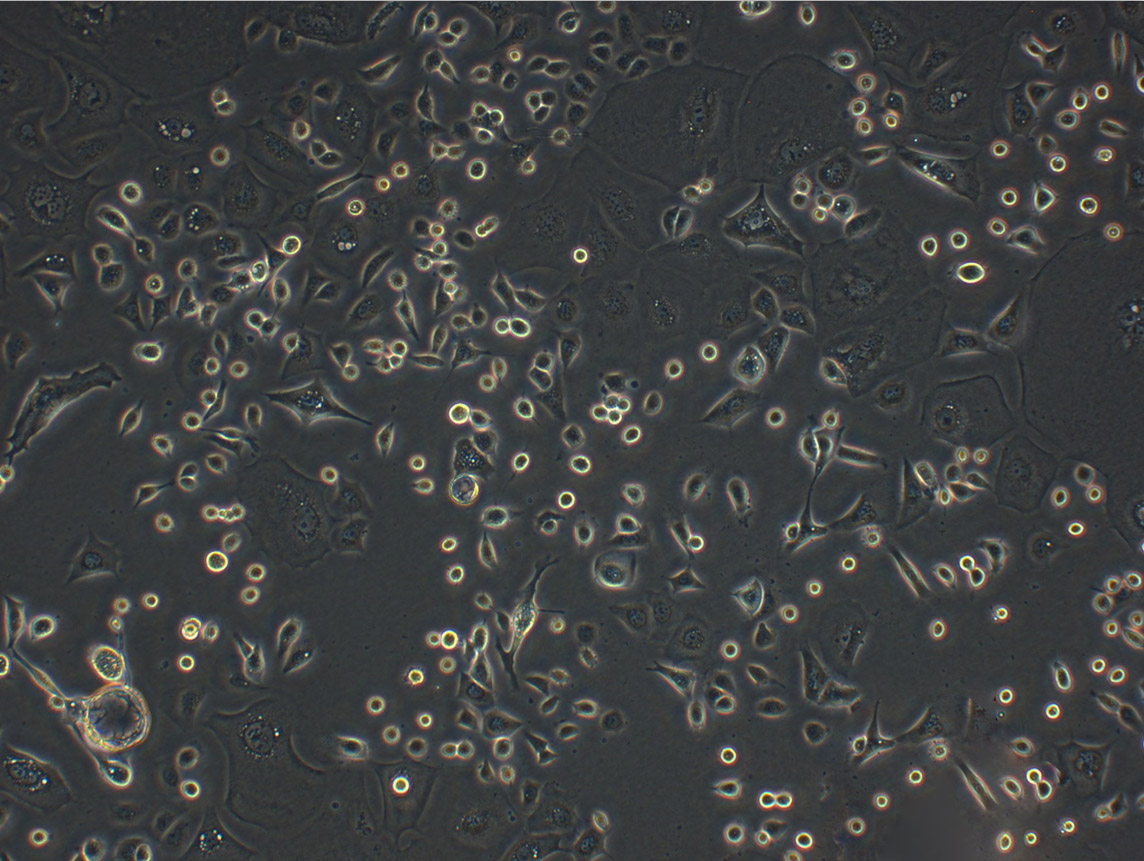 NCI-H1666 epithelioid cells人肺支气管癌细胞系