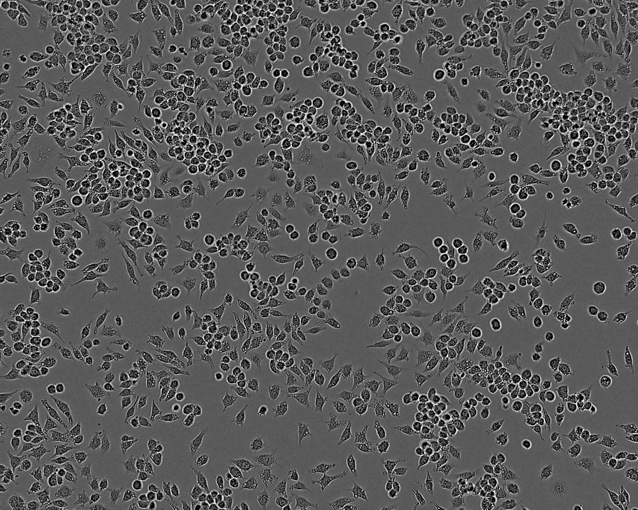 HLF-a epithelioid cells人肺细胞系