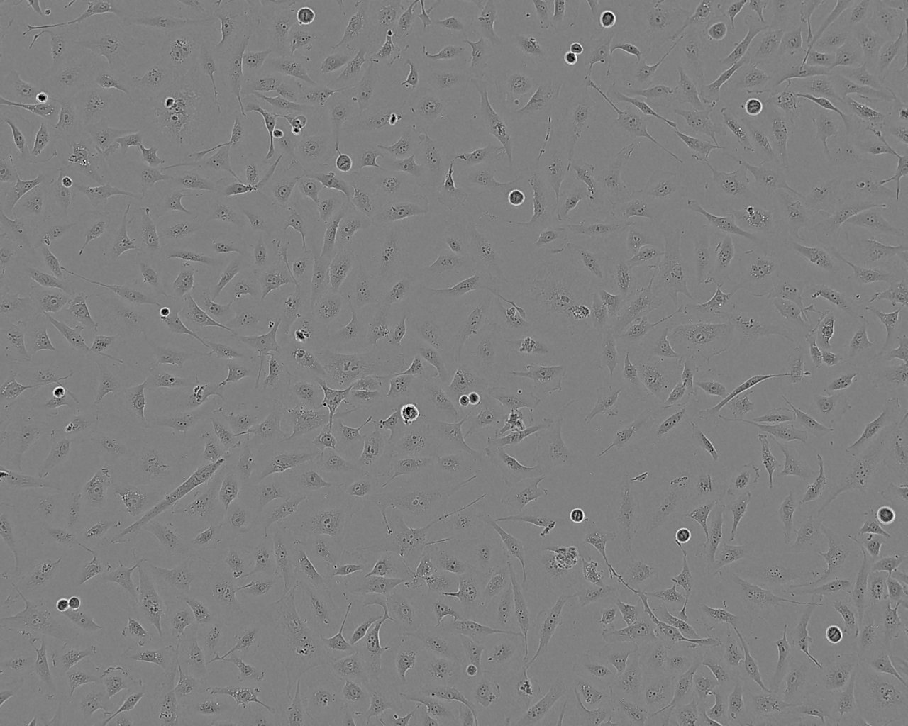 NCI-H1437 epithelioid cells人非小细胞肺癌细胞系