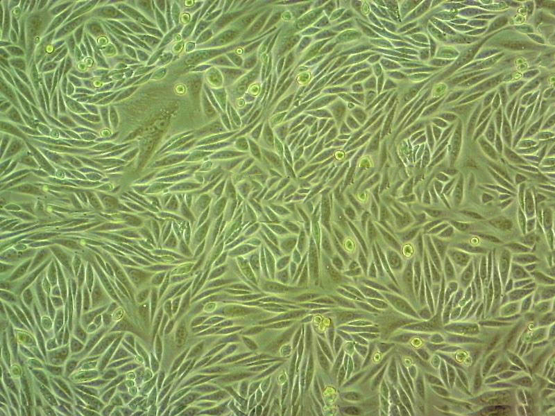 RA-FLSs Cell:类风湿关节炎成纤维样滑膜细胞系