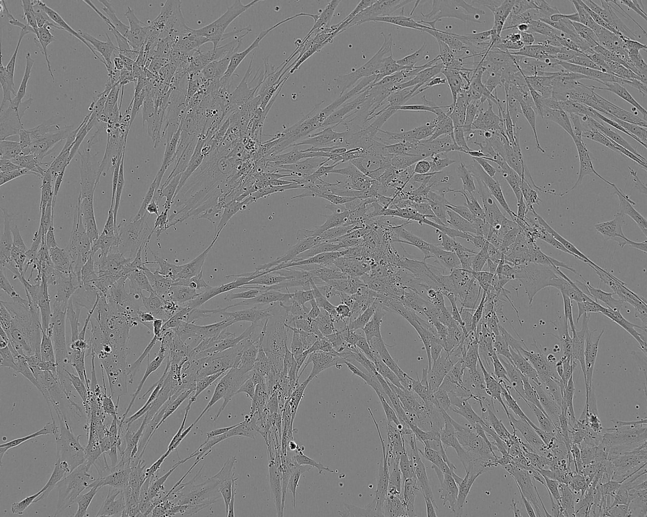 NRK-49F Cell:大鼠正常肾成纤维细胞系