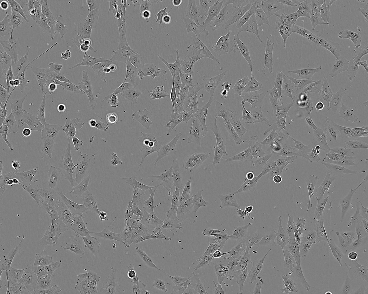 CCD-18Co Cell:正常人结肠成纤维细胞系