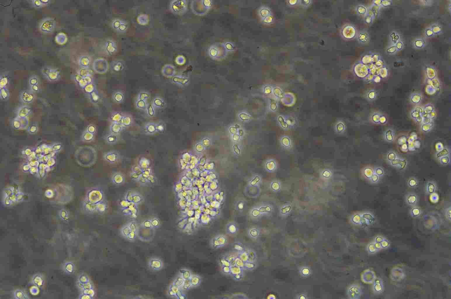 MOLT-4 Cell:人急性淋巴母细胞性白血病细胞系