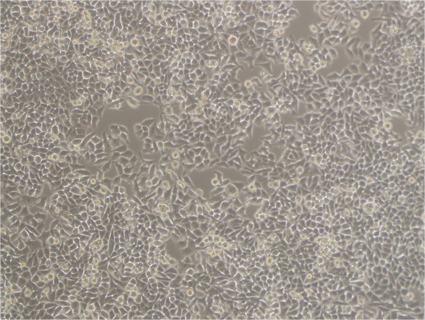 OCM-1 epithelioid cells人眼脉络膜黑色素瘤细胞系