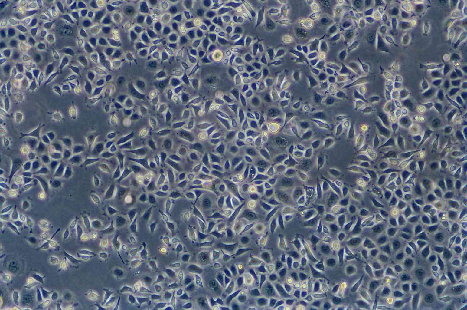 YTMLC-90 epithelioid cells人肺鳞癌细胞系