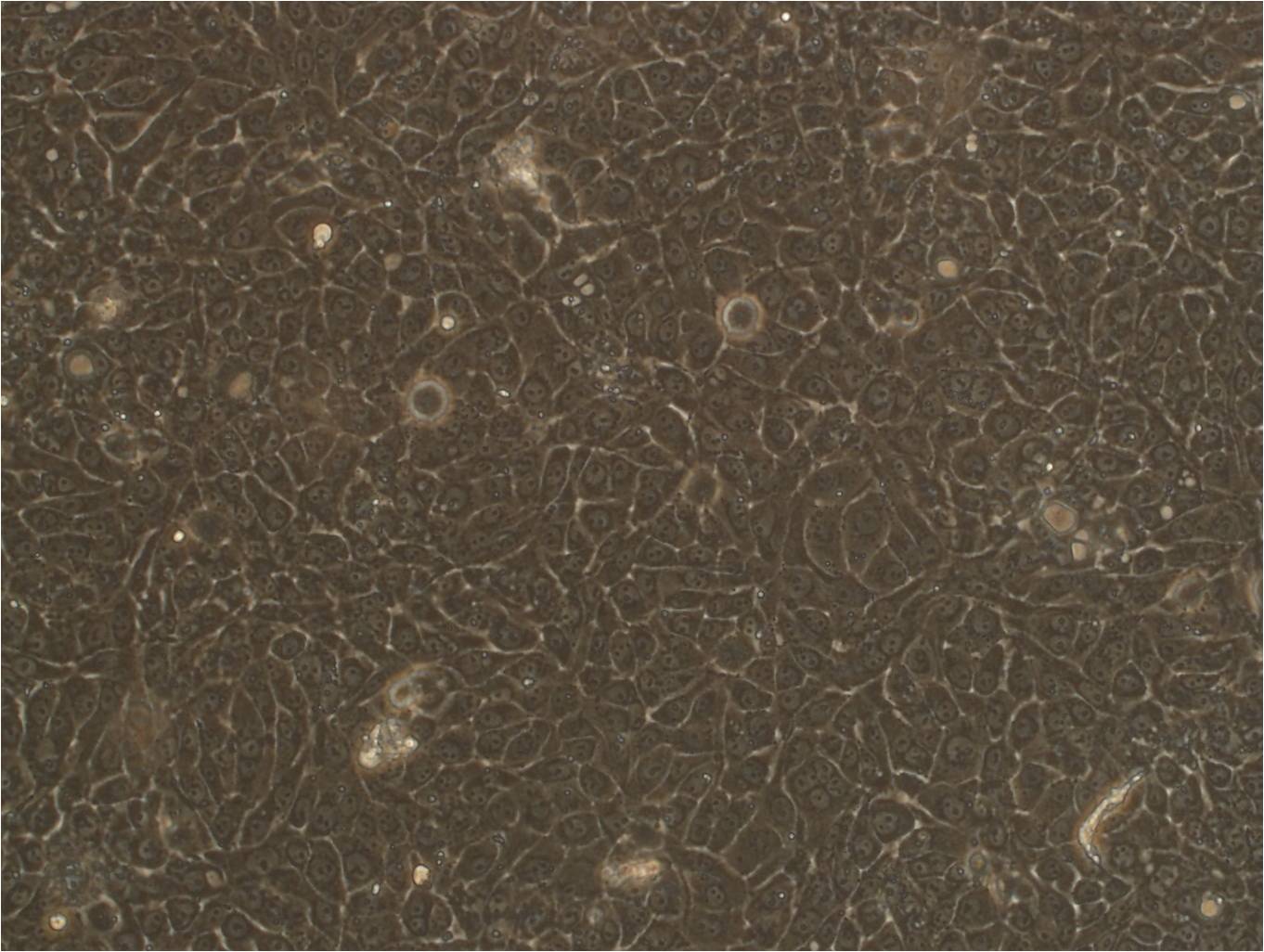 Mel-RM epithelioid cells人黑色素瘤细胞系